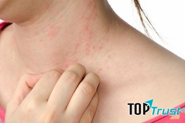 Bác sĩ Đỗ Văn Thành là địa chỉ tin cậy điều trị bệnh da liễu