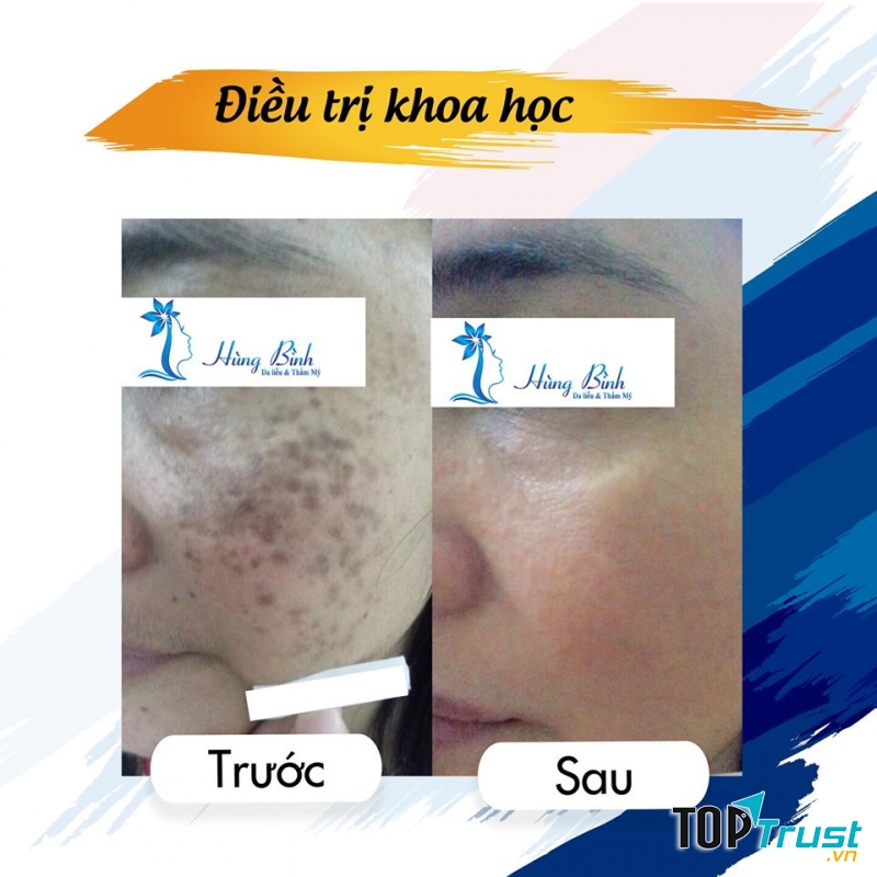 Bác Sỹ Chuyên Khoa II . Nguyễn Bá Hùng - Da liễu thẩm mỹ Hùng Bình