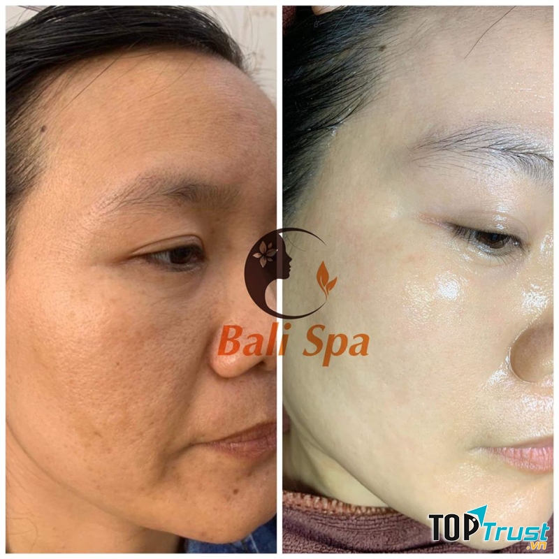 Bali Spa