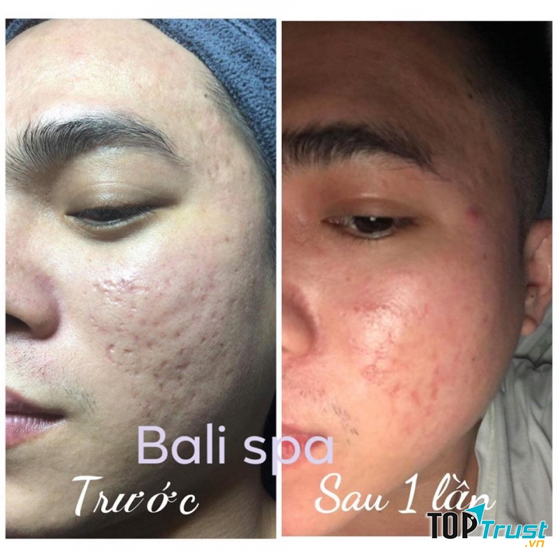 Bali Spa & Clinic