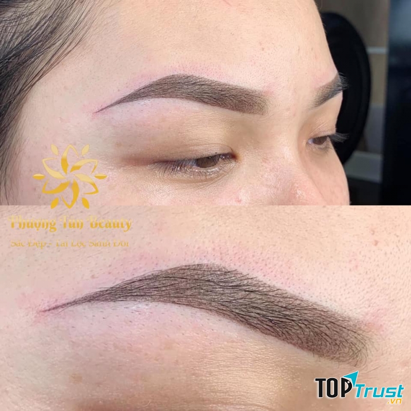 Bấm Mí - Dr. Phượng Tũn Hải Dương