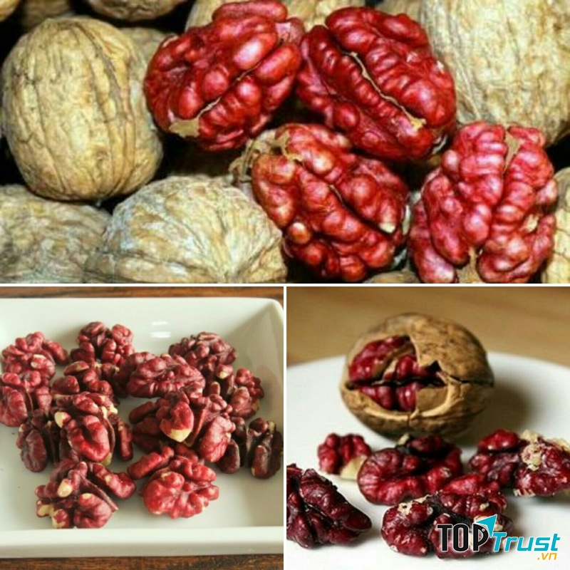 Óc chó cung cấp canxi cho xương khớp khỏe