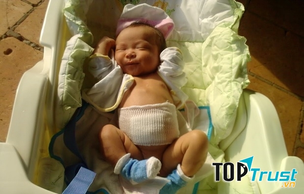 Bất kỳ trẻ nào cũng có thể tắm nắng