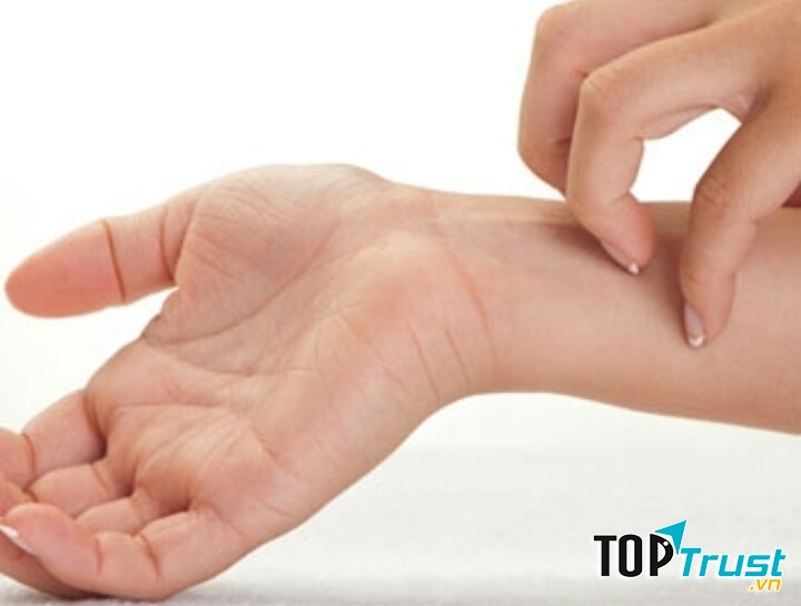 Bất thường trên da