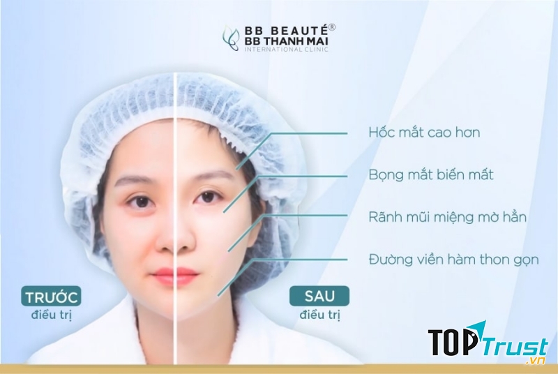 BB Beauté - BB Thanh Mai