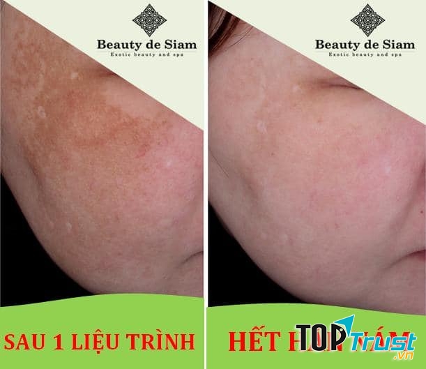 Beauty de Siam Bến Tre