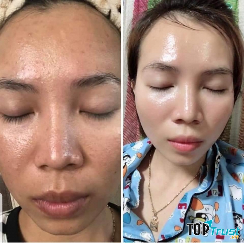 Been Spa