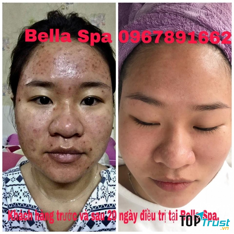 Lượng khách tới điều trị mỗi ngày tại Bella Spa thường rất đông.
