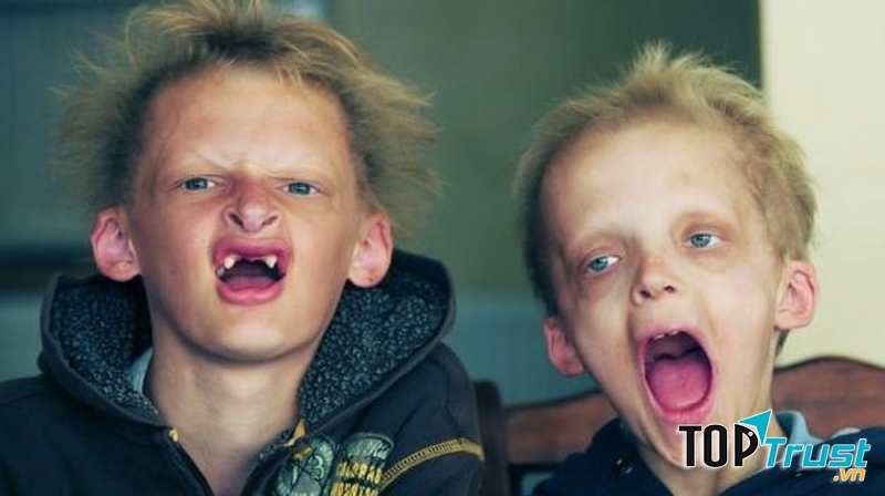 Bệnh ma cà rồng