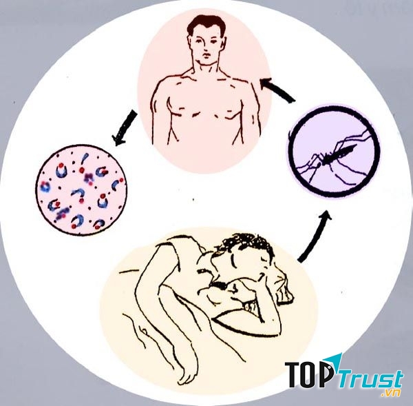 Bệnh sốt rét – dịch bệnh trên thế giới