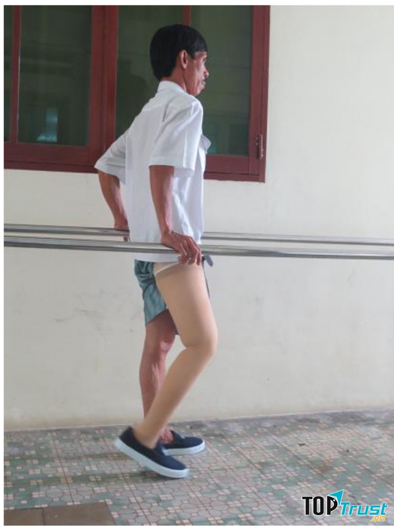 BỆNH VIỆN CHỈNH HÌNH VÀ PHỤC HỒI CHỨC NĂNG THÀNH PHỐ HỒ CHÍ MINH