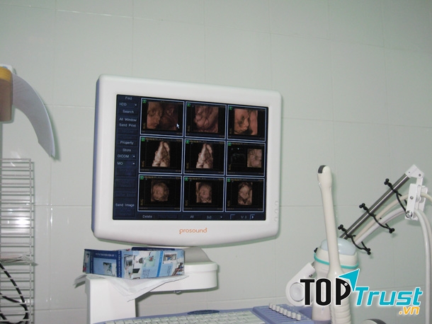 Siêu âm 3D 4D