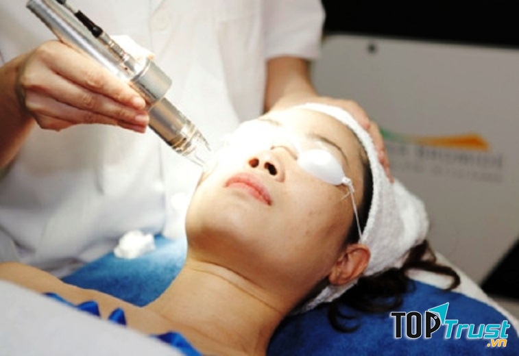 Bác sĩ điều trị nám cho bệnh nhân bằng công nghệ Laser