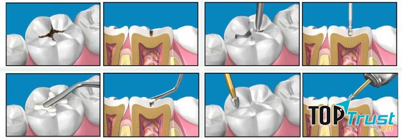 Bệnh viện Thái Thượng Hoàng