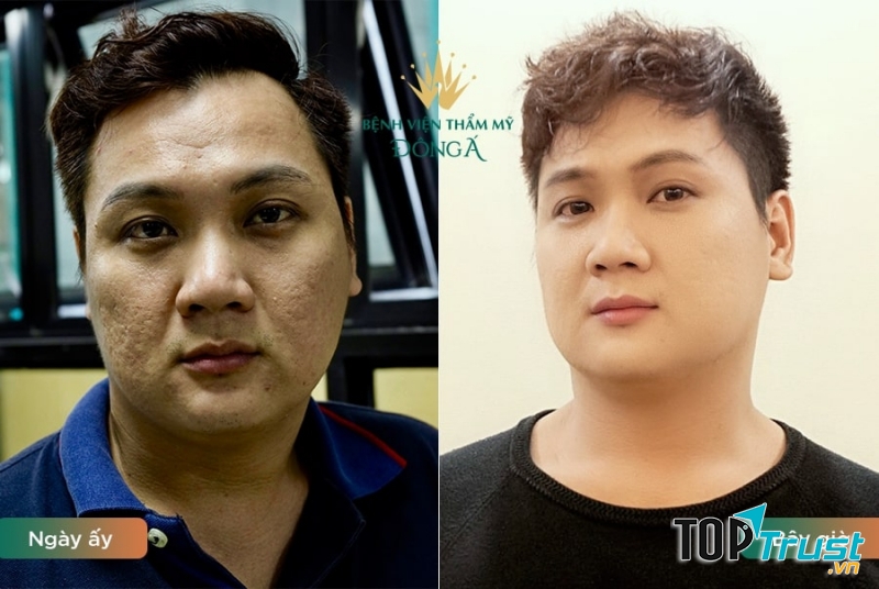 Bệnh viện thẩm mỹ Đông Á Hà Nội