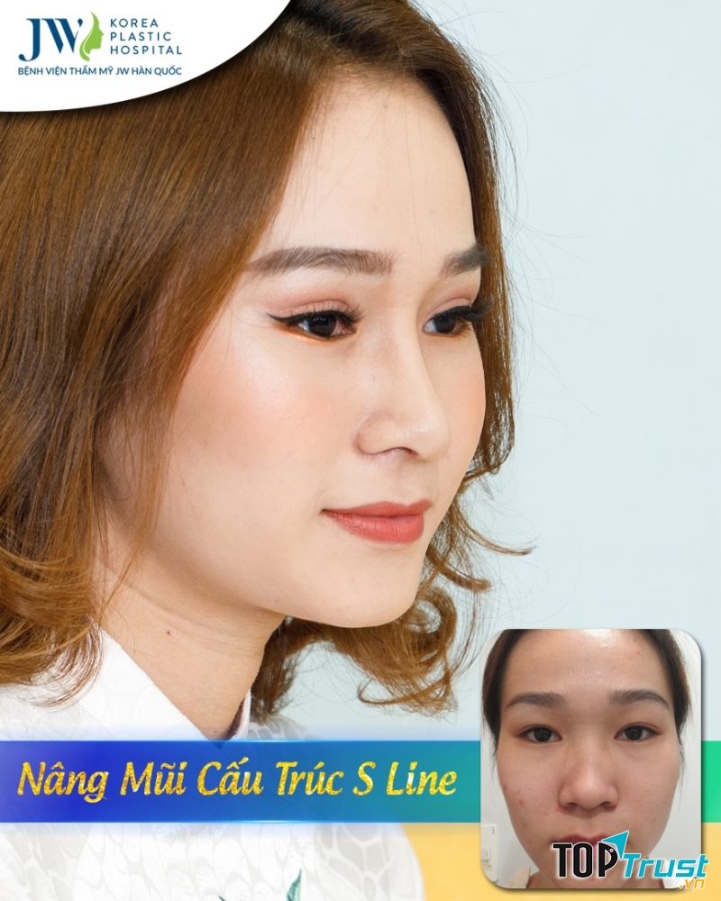 Bệnh viện thẩm mỹ JW Hàn Quốc