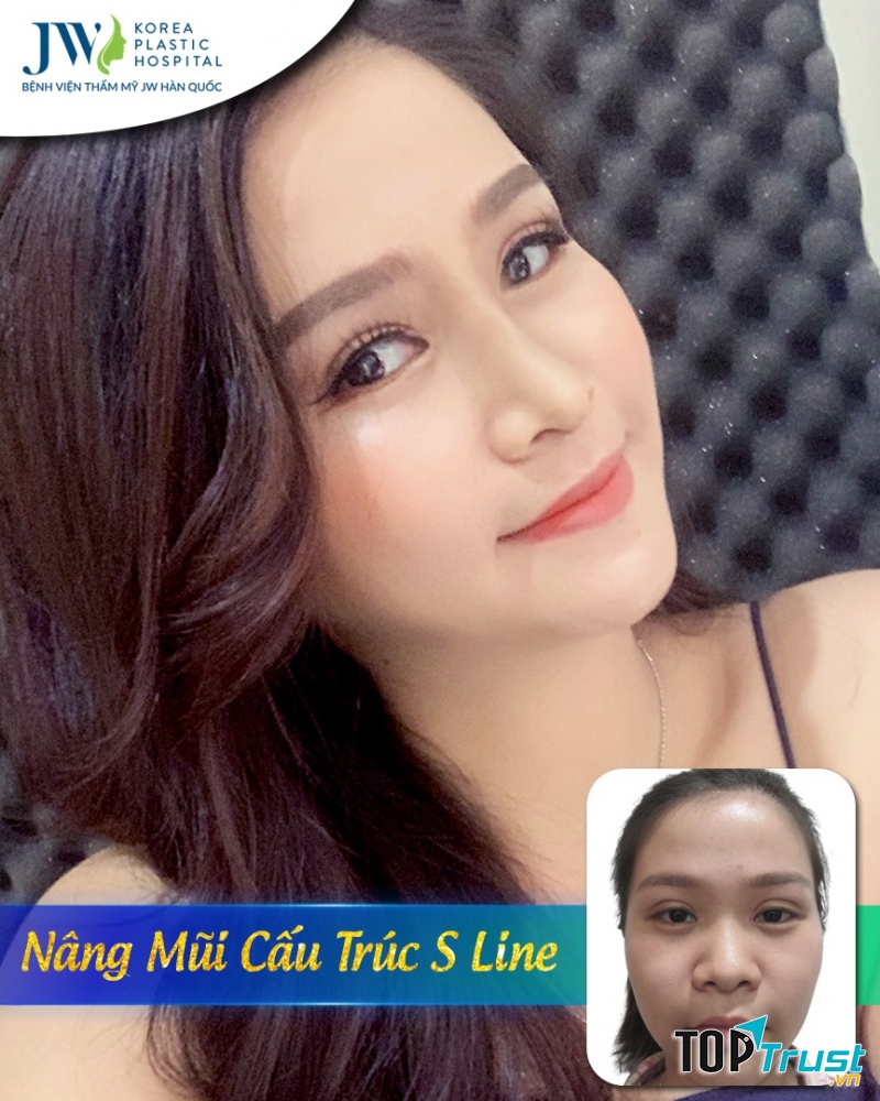 Bệnh viện thẩm mỹ JW Hàn Quốc