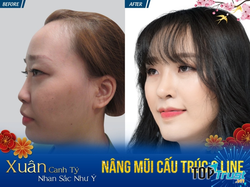 Bệnh Viện Thẩm Mỹ JW Hàn Quốc