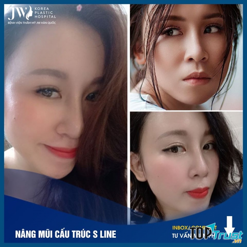 Bệnh Viện Thẩm Mỹ JW Hàn Quốc