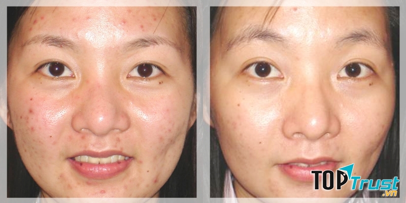 Bệnh viện thẩm mỹ Kangnam