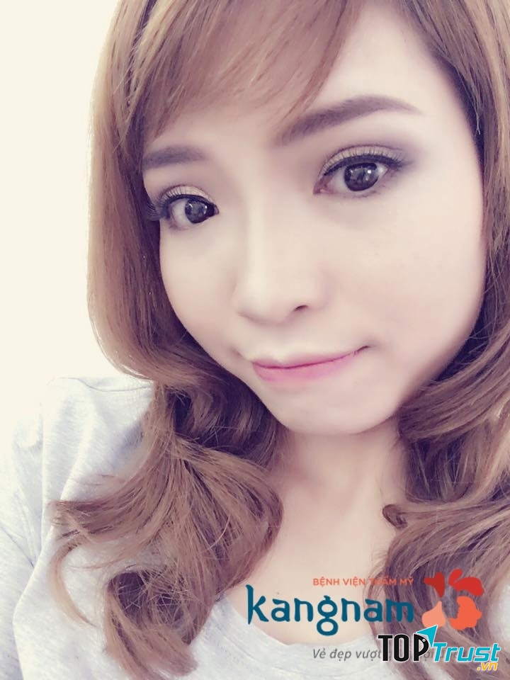 Bệnh viện thẩm mỹ Kangnam - địa chỉ nhấn mí mắt đẹp và an toàn nhất ở TP. HCM