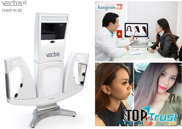 Chỉnh hàm hô công nghệ 3D tại TMV Kangnam