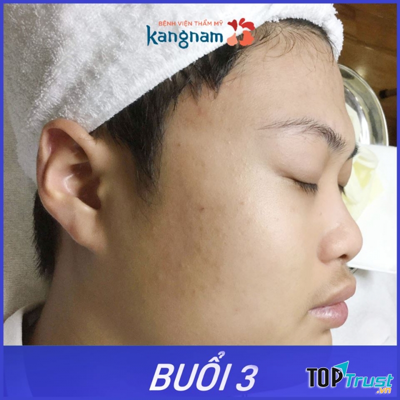 Bệnh viện thẩm mỹ Kangnam