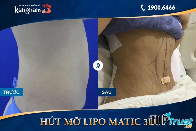 Bệnh viện thẩm mỹ Kangnam
