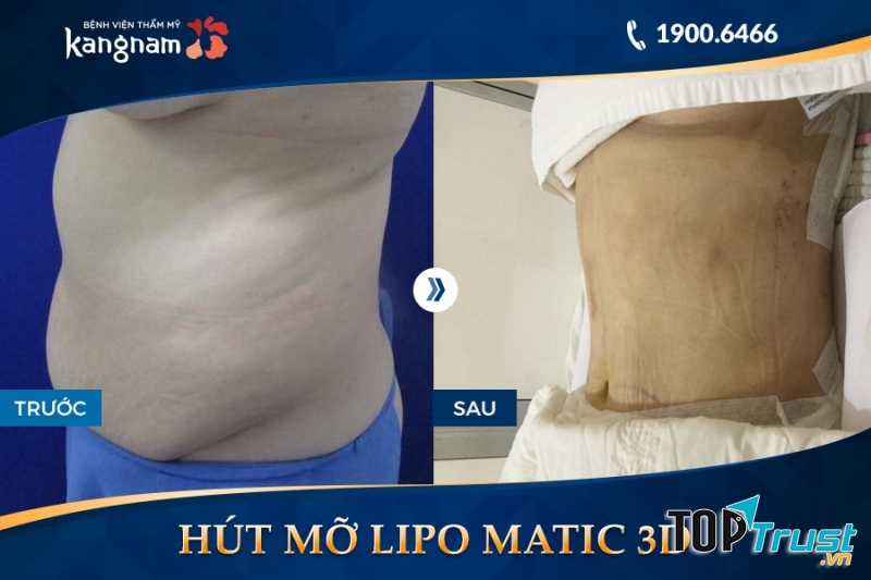 Bệnh viện thẩm mỹ Kangnam