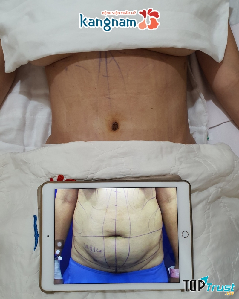 Bệnh viện thẩm mỹ Kangnam