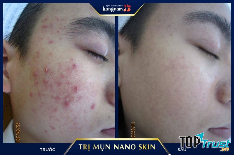 Bệnh viện thẩm mỹ Kangnam - Cơ sở Hà Nội