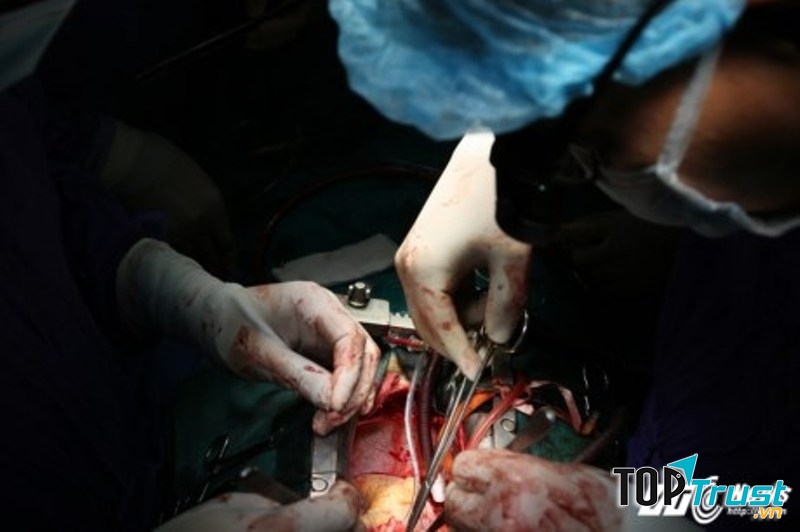 Hình ảnh phẫu thuật tim tại bệnh viện Việt Đức