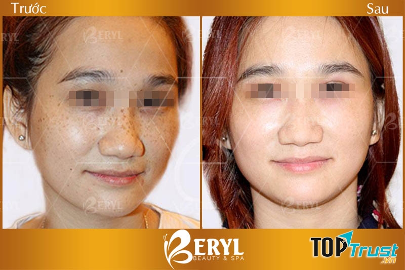 Beryl Beauty Spa