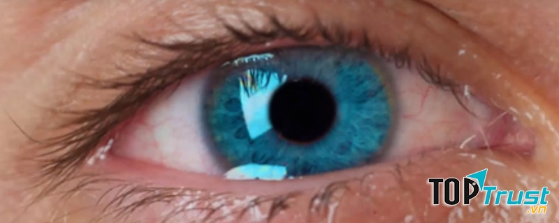 Bị chảy nước mắt