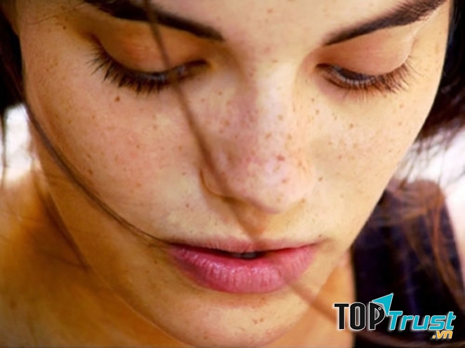 Nám da do rối loạn nội tiết