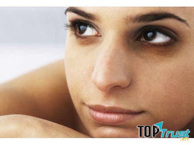 Bị quầng thâm dưới mắt