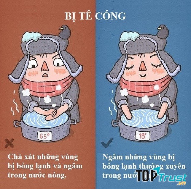 Xử lí khi bị tê cóng