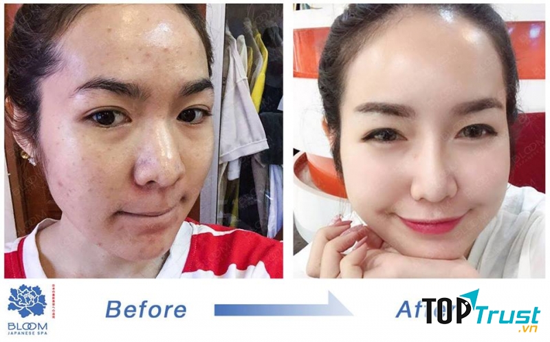 Bloom Spa - Spa Nhật Bản
