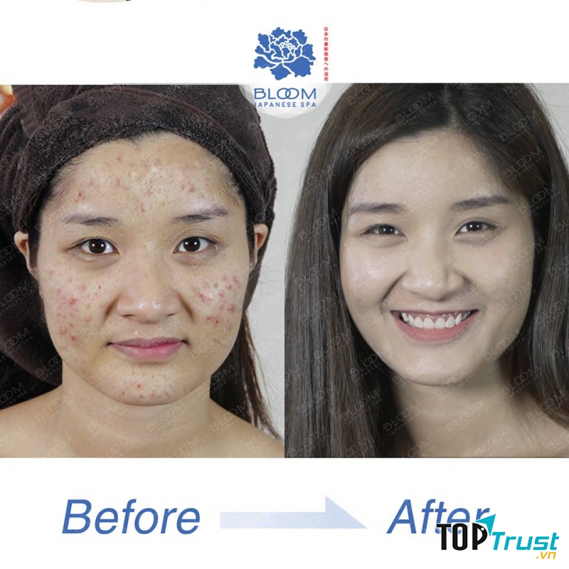 Bloom Spa - Spa Nhật Bản