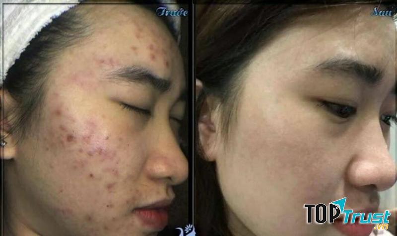 Bluebeauty Spa