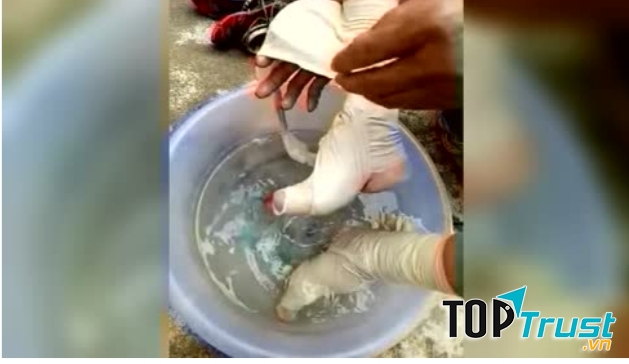 Hủ tục bó chân