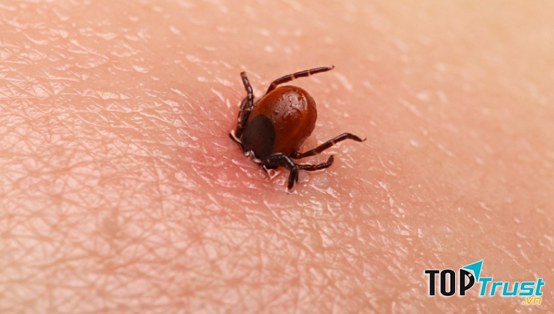 Bọ chét tấn công người