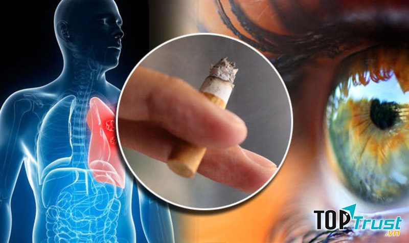 Hãy cố gắng bỏ hút thuốc lá bằng mọi giá.