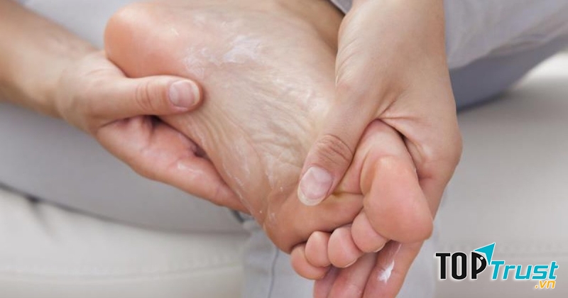 Nguyên nhân gây bong da không chỉ là do bạn đang thiếu chất