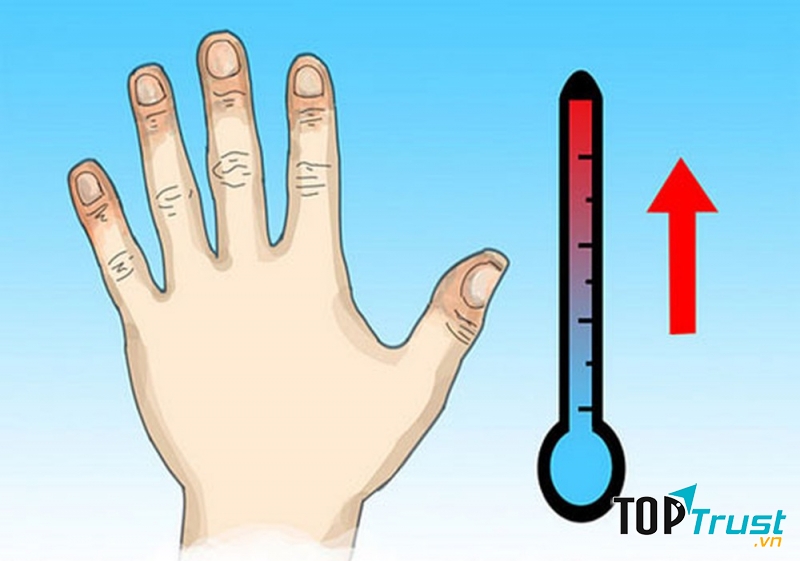 Bỏng lạnh - Bị tê cóng