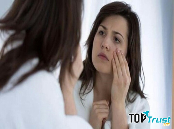 Mắt thâm quầng là tình trạng phổ biến của người viêm gan B