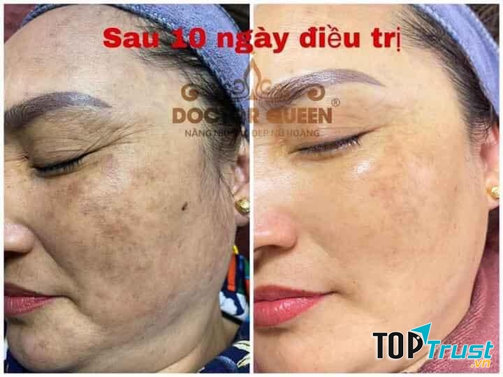 BÔNG SPA