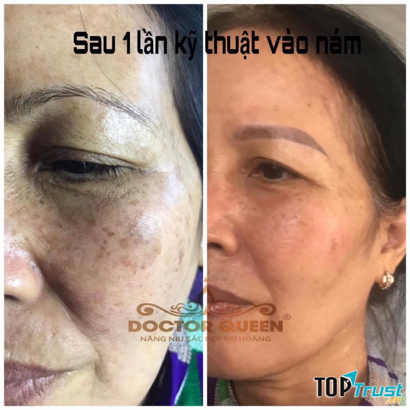 BÔNG SPA