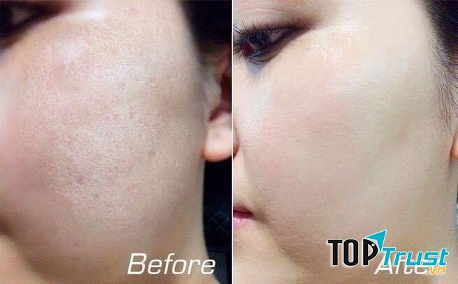 Bông Spa - Healthy & Beauty