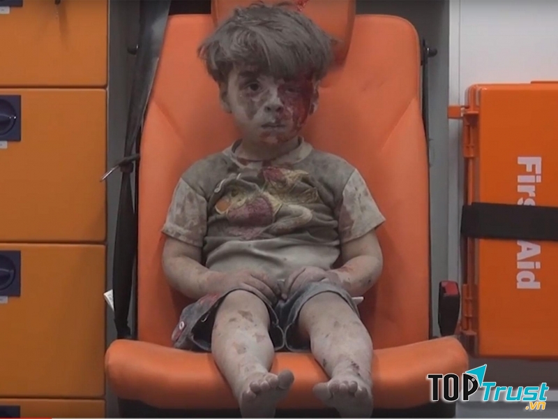 Bậu bé 5 tuổi người Syria trên chiếc xe cứu thương